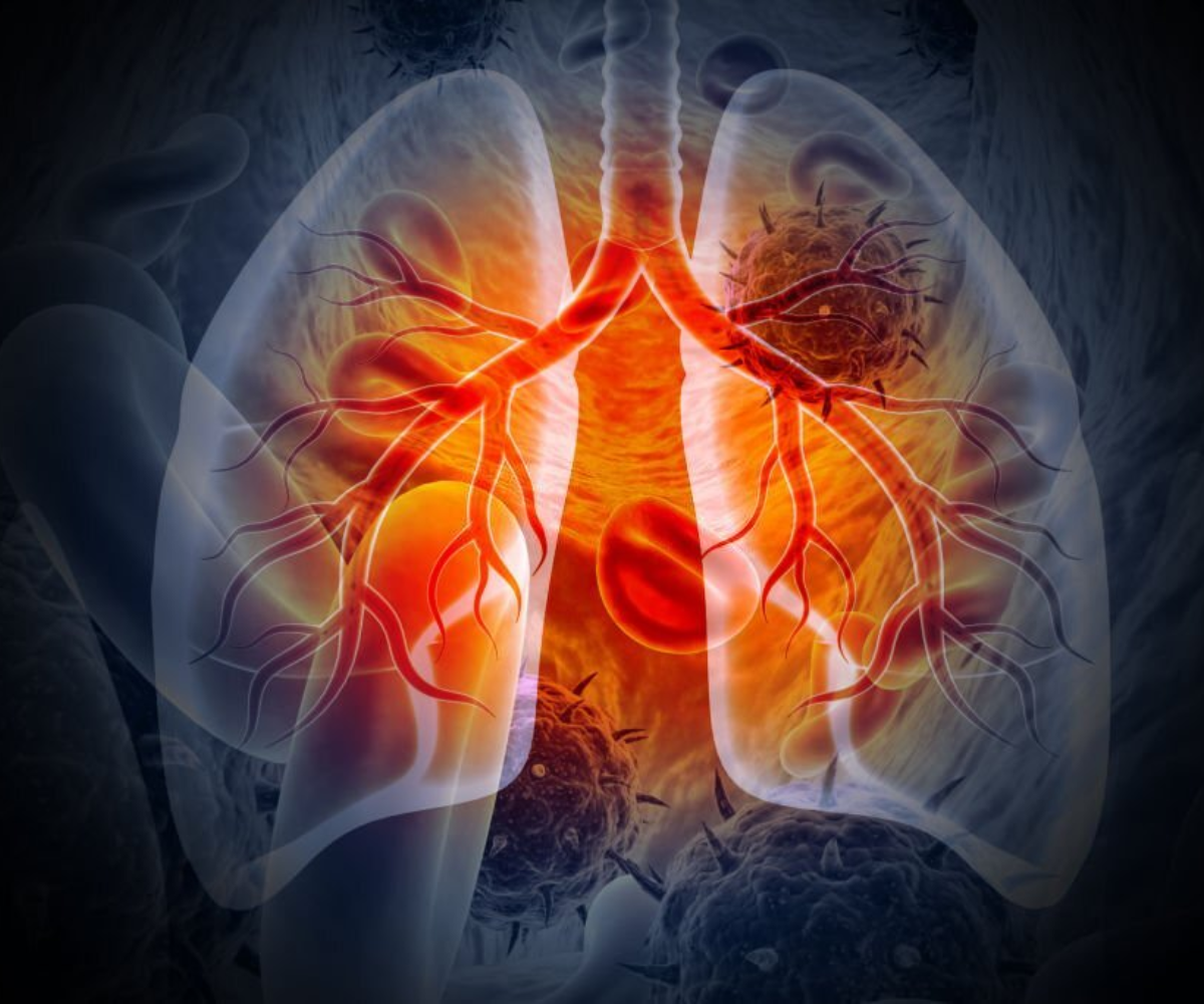 Chronic Obstructive Pulmonary Disease Gericocare